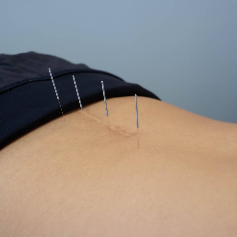 Naturopathic Doctor and Acupuncturist in Tulsa, OK