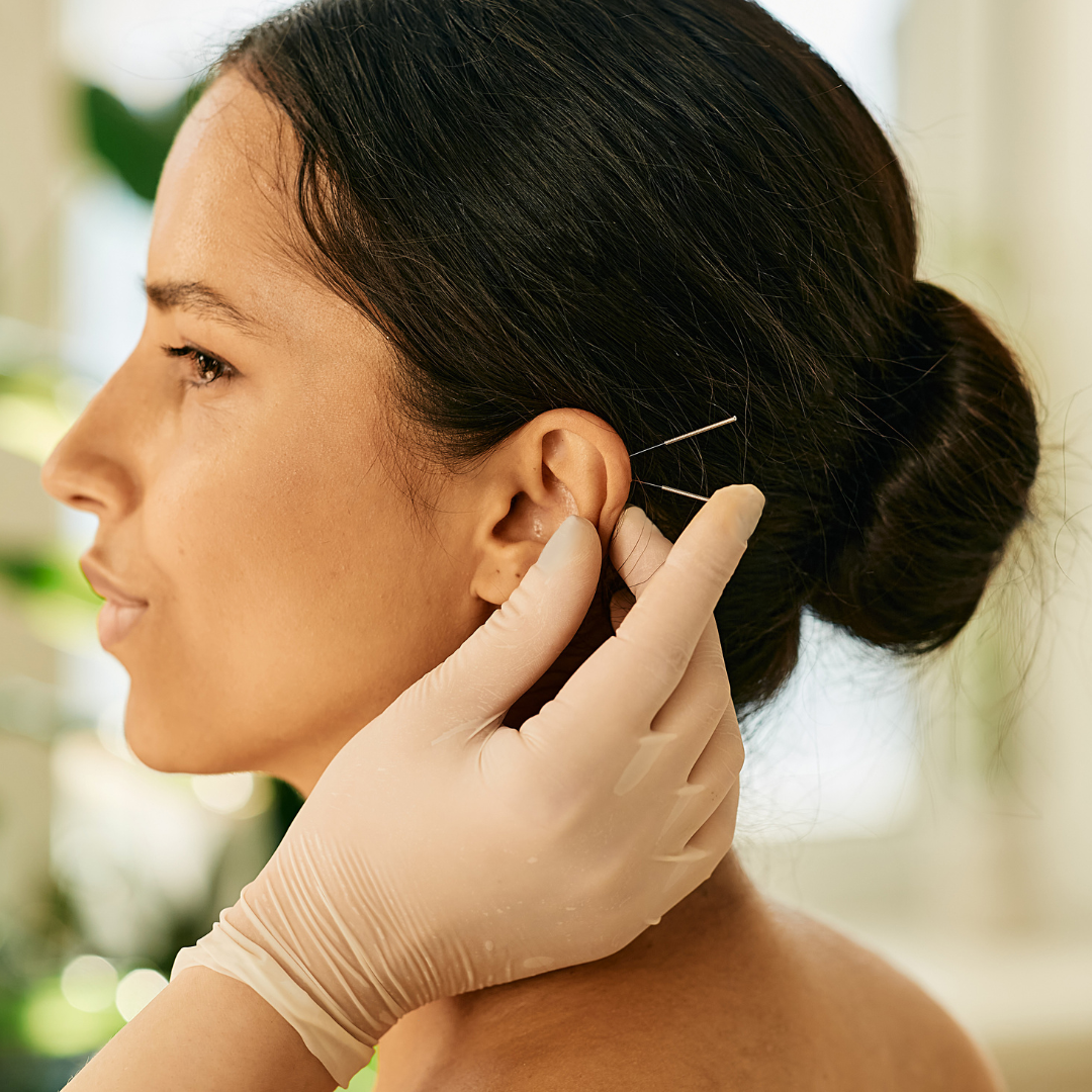 Acupuncture for Pain in Tulsa, OK