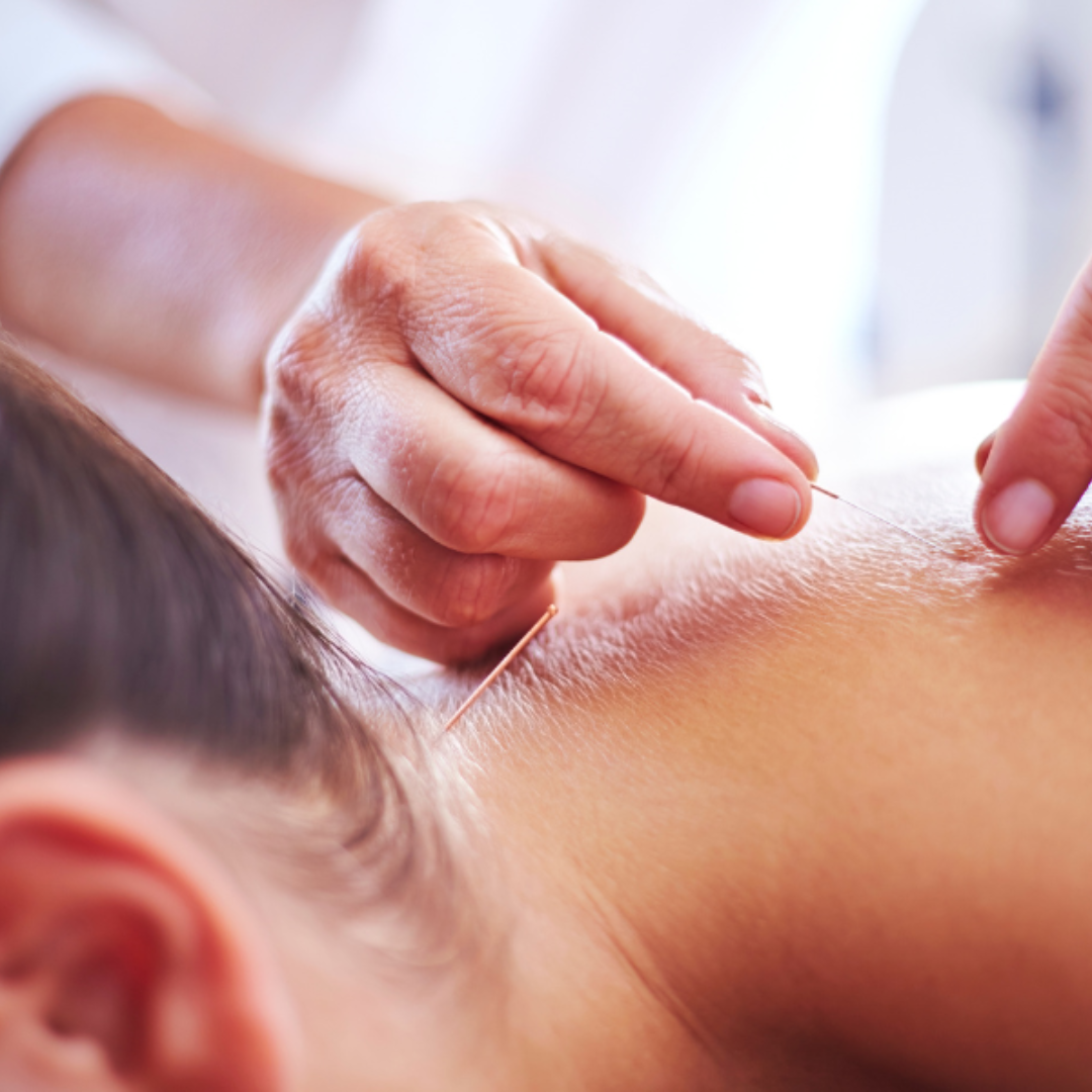 Pediatric Acupuncture in Tulsa, OK