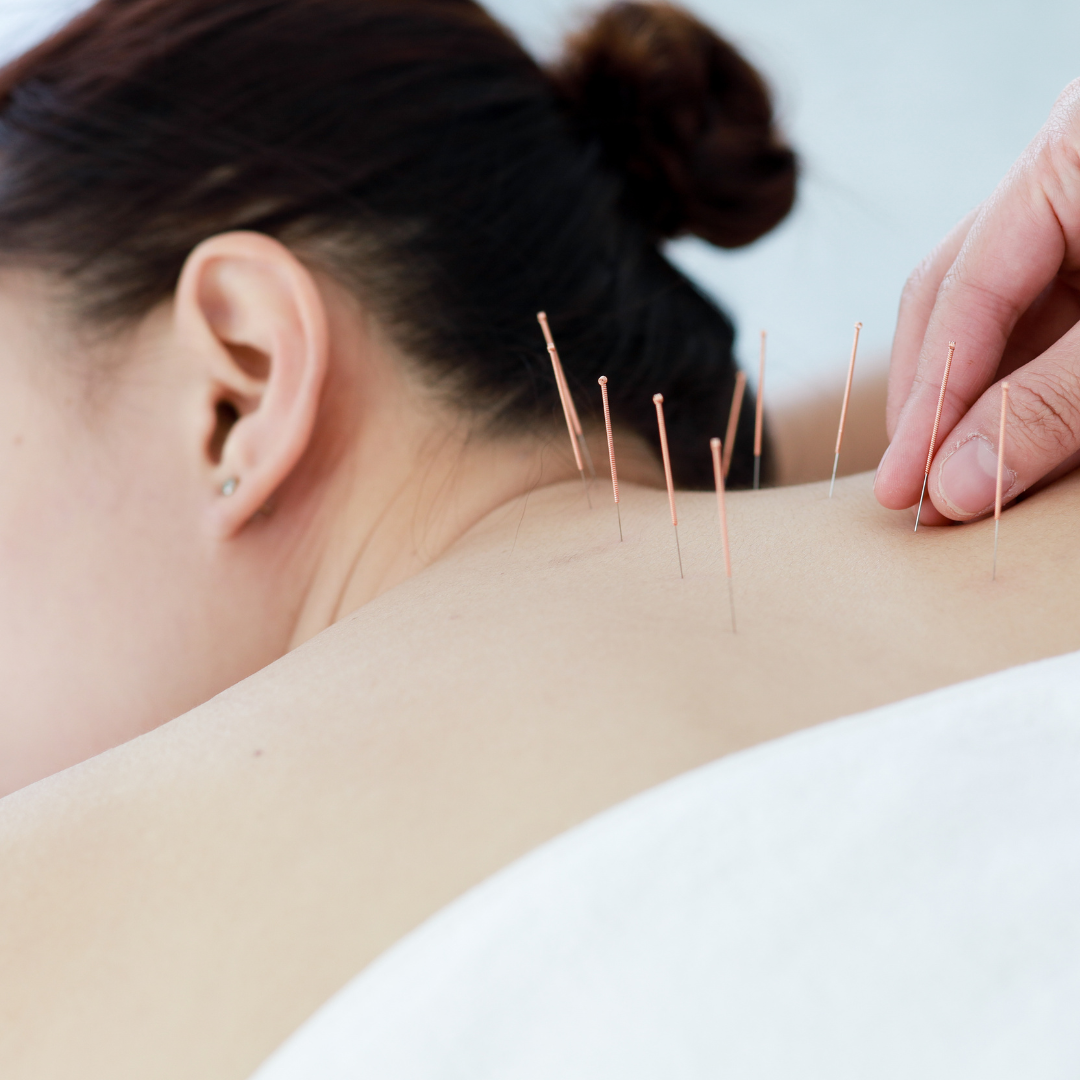 Acupuncture for Women's Health in Tulsa, OK